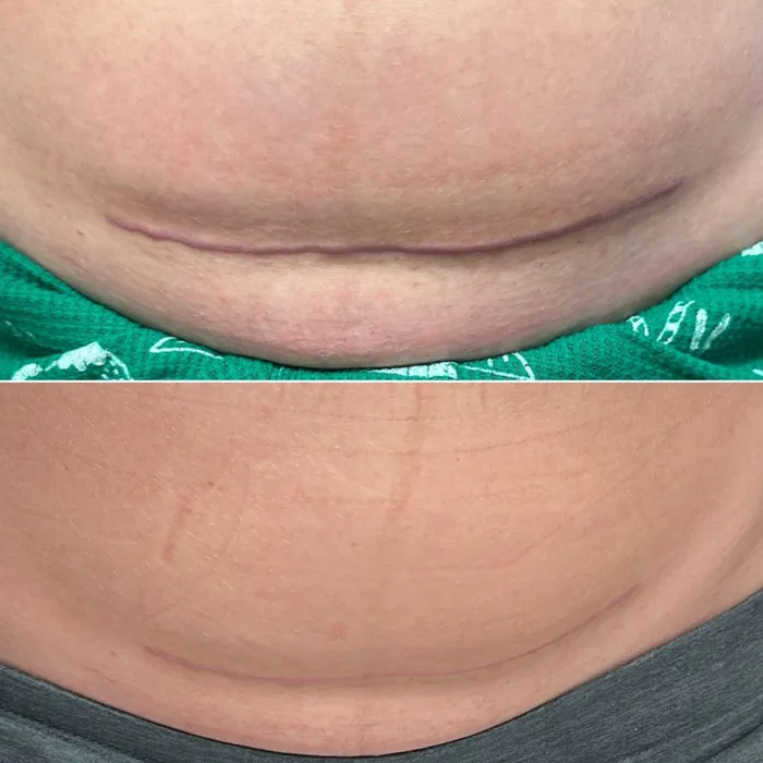 Antes (acima) e depois (abaixo) 1