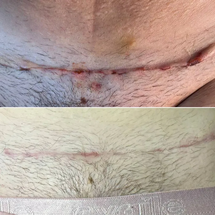 Antes (acima) e depois (abaixo) 2