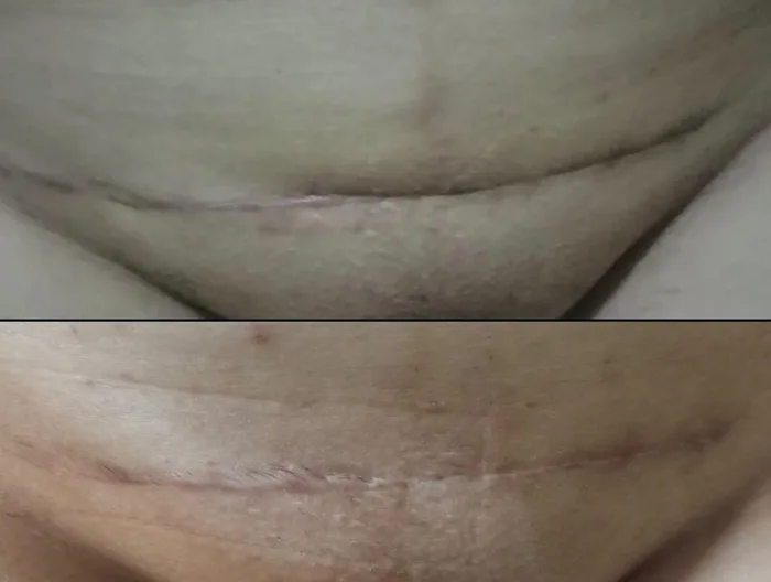 Antes (acima) e depois (abaixo) 4